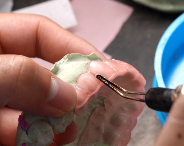 Close-up of a dental technician using a precision tool to work on a gold dental prosthetic with embedded gemstones, wearing a dust-covered glove.