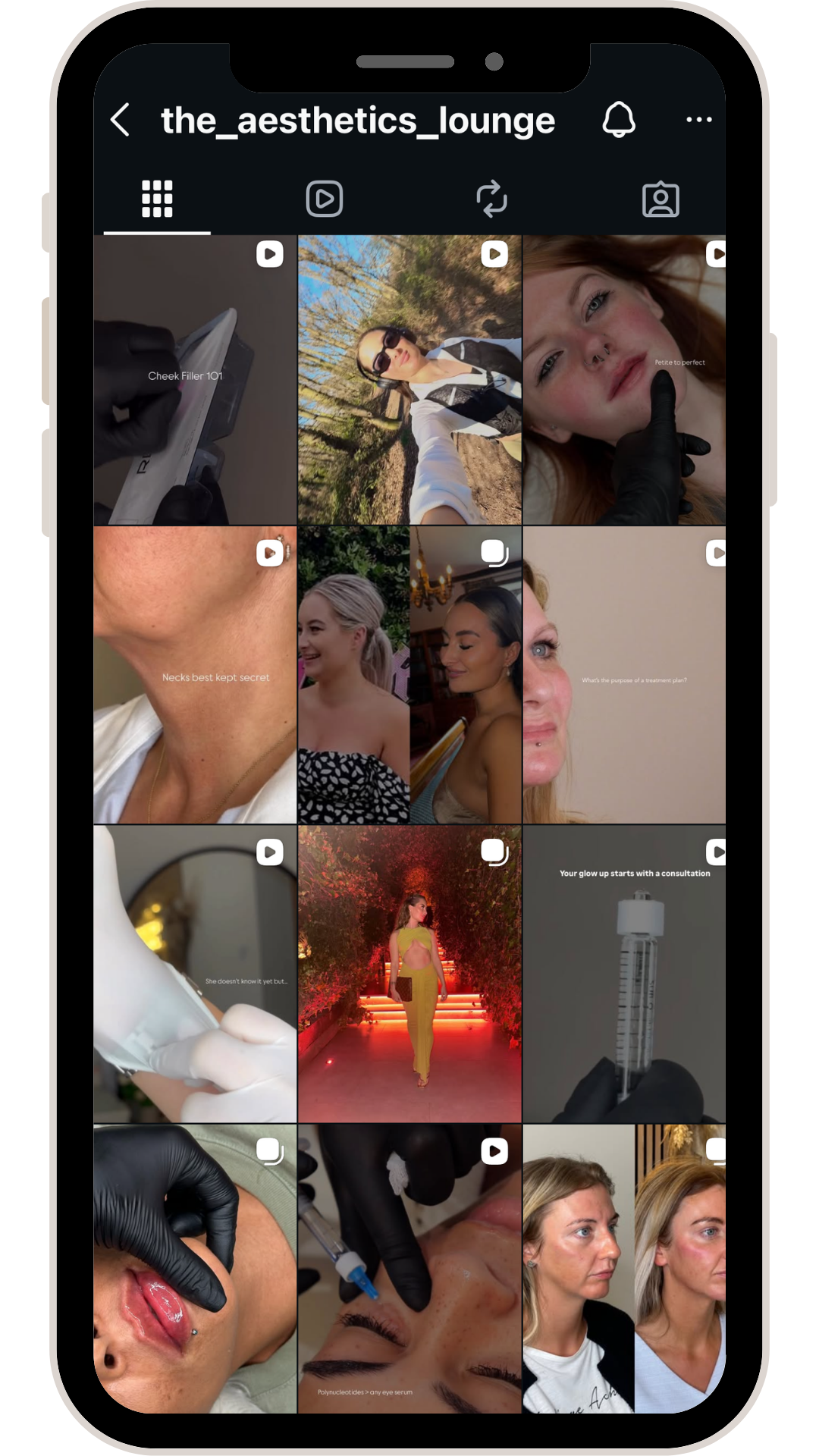 Instagram profile page showing various videos and images related to aesthetic treatments, skincare, and cosmetic procedures. Includes photos of consultations, skincare products, and before-and-after results.