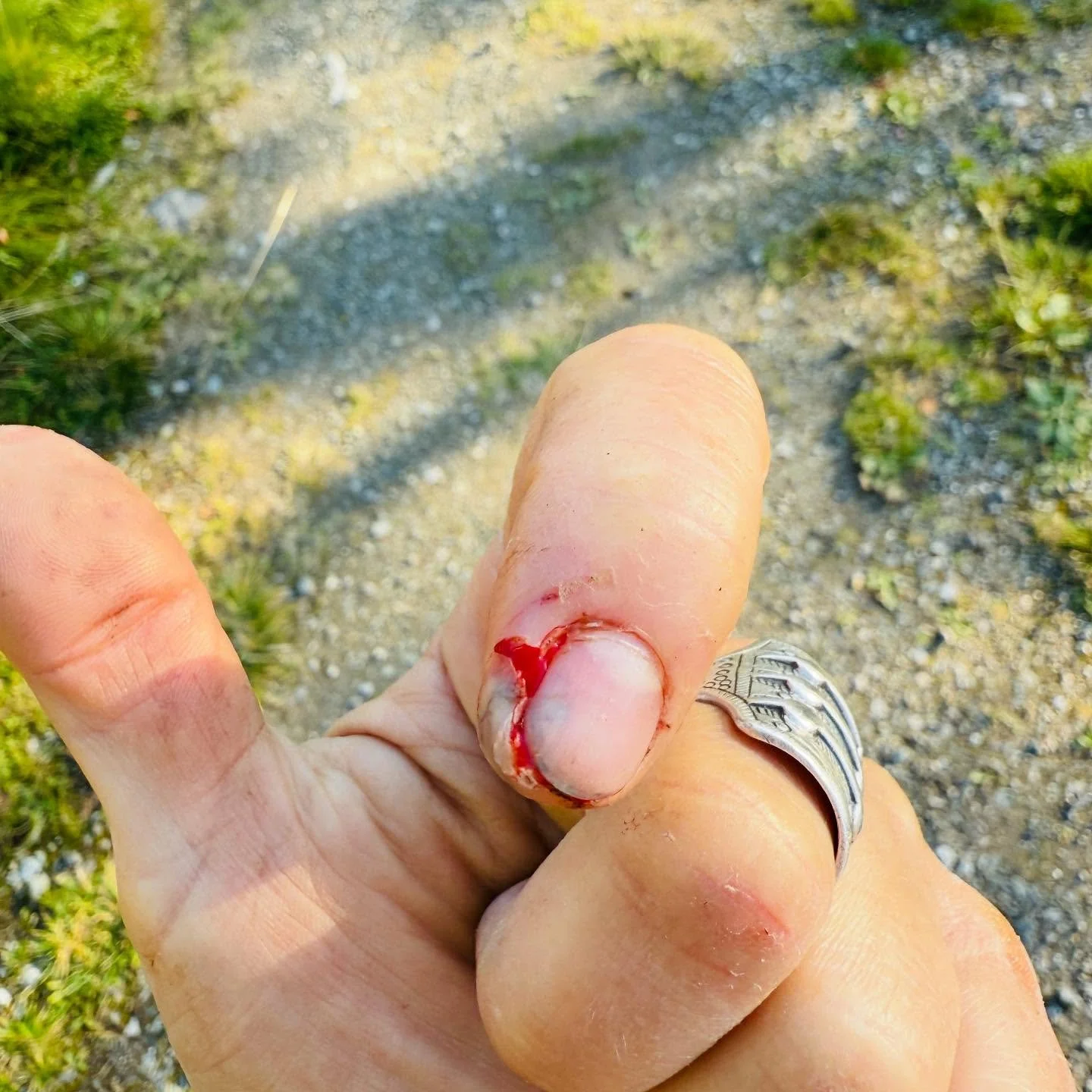 AI AI AI! 🩹😁 Litt svinn m&aring; man regne med p&aring; veien mot m&aring;let &ndash; blodnegl kjennes godt n&aring;r hammeren lever sitt eget liv! 🔨😵&zwj;💫

Heldigvis funker b&aring;de h&oslash;yreh&aring;nda og snakket&oslash;yet fortsatt, s&a