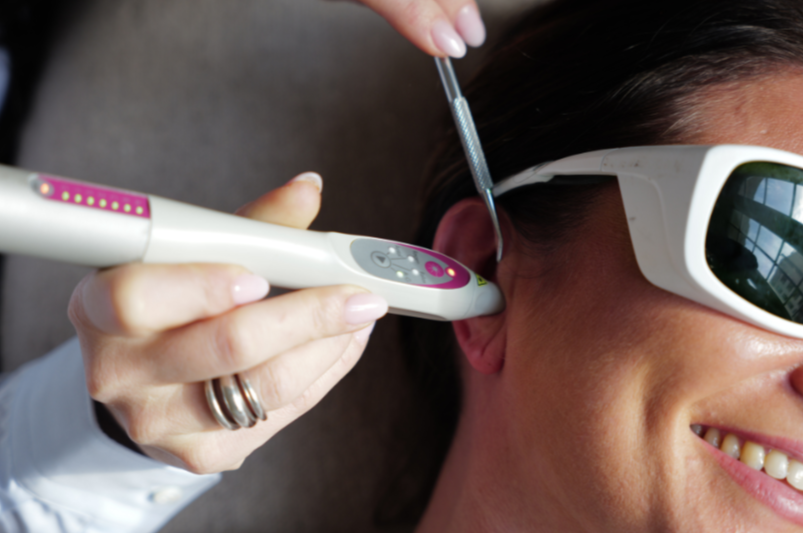 Cinzia Di Domenico — séance auriculothérapie laser Tassin Lyon