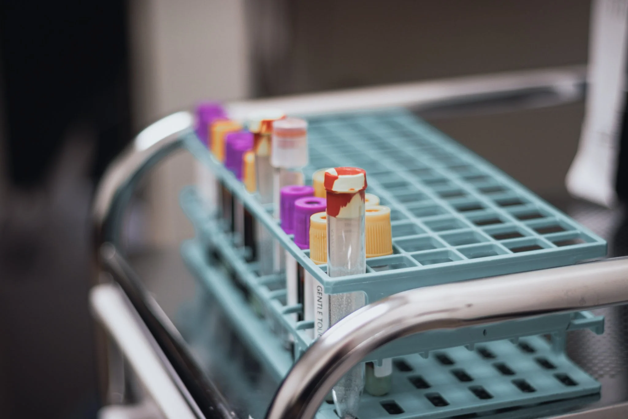 Medical test tubes with colored caps on a hospital cart.