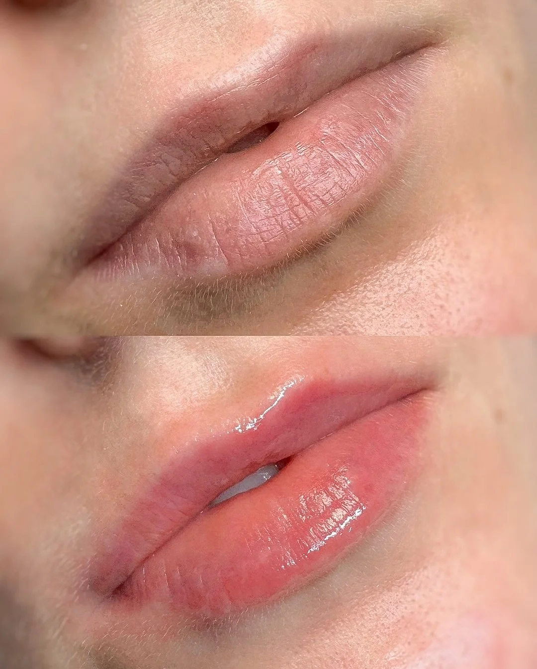 L&aacute;bios secos, com peles soltas e sem vida? O HydraGloss &eacute; para ti 💋

Ajuda a suavizar linhas finas, melhora a textura e devolve a vitalidade natural dos l&aacute;bios!

Resultado?
✨ L&aacute;bios mais bonitos
💧 Mais hidratados
🤍 Com 