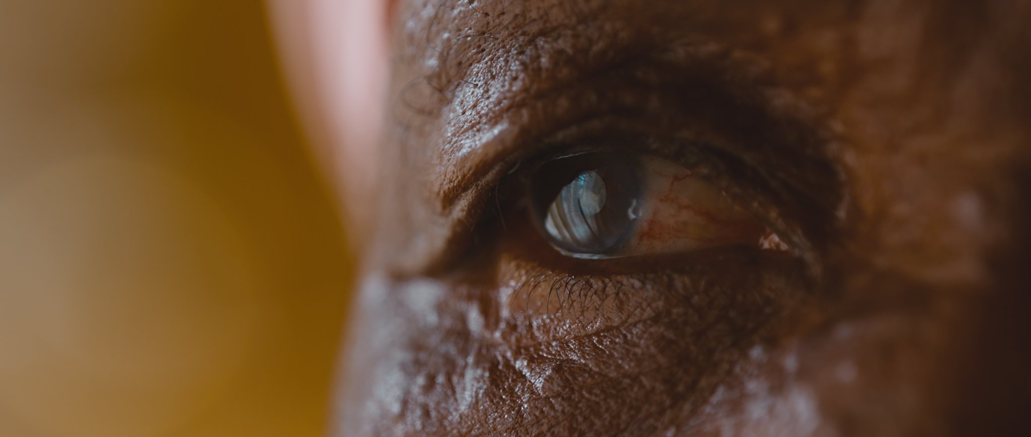 Close-up of a person's eye with detailed skin texture around the eye. Documentary Cinematography work. 