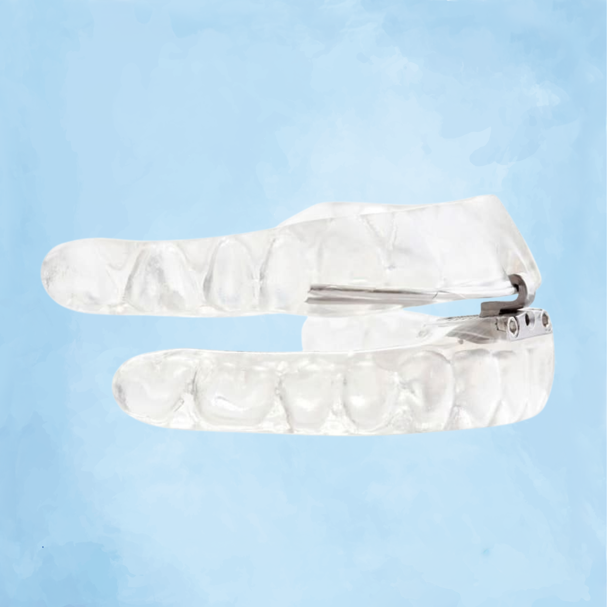 Oral Appliance Therapy: A Convenient Alternative to CPAP