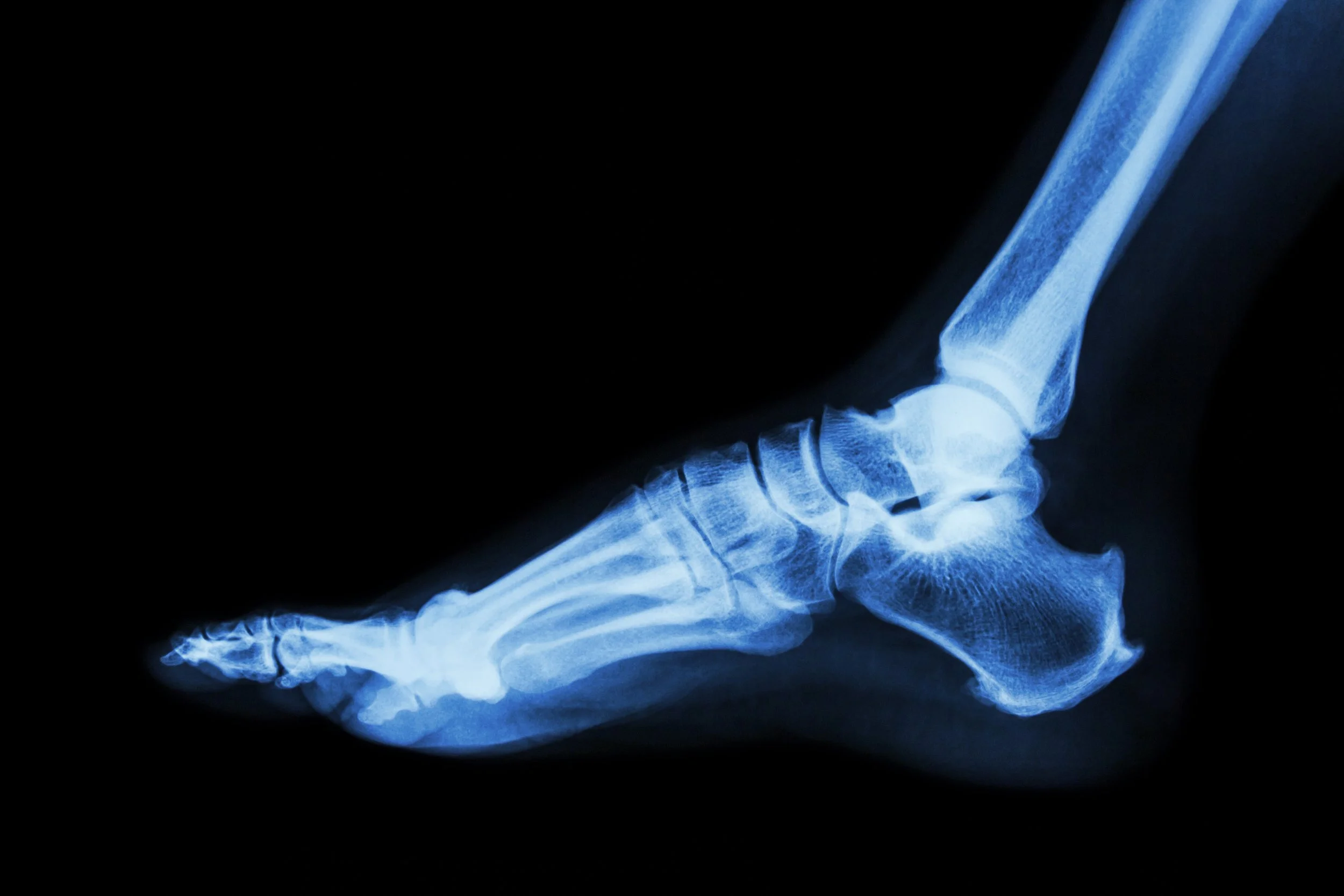 X-ray image of foot and ankle for podiatrist examination