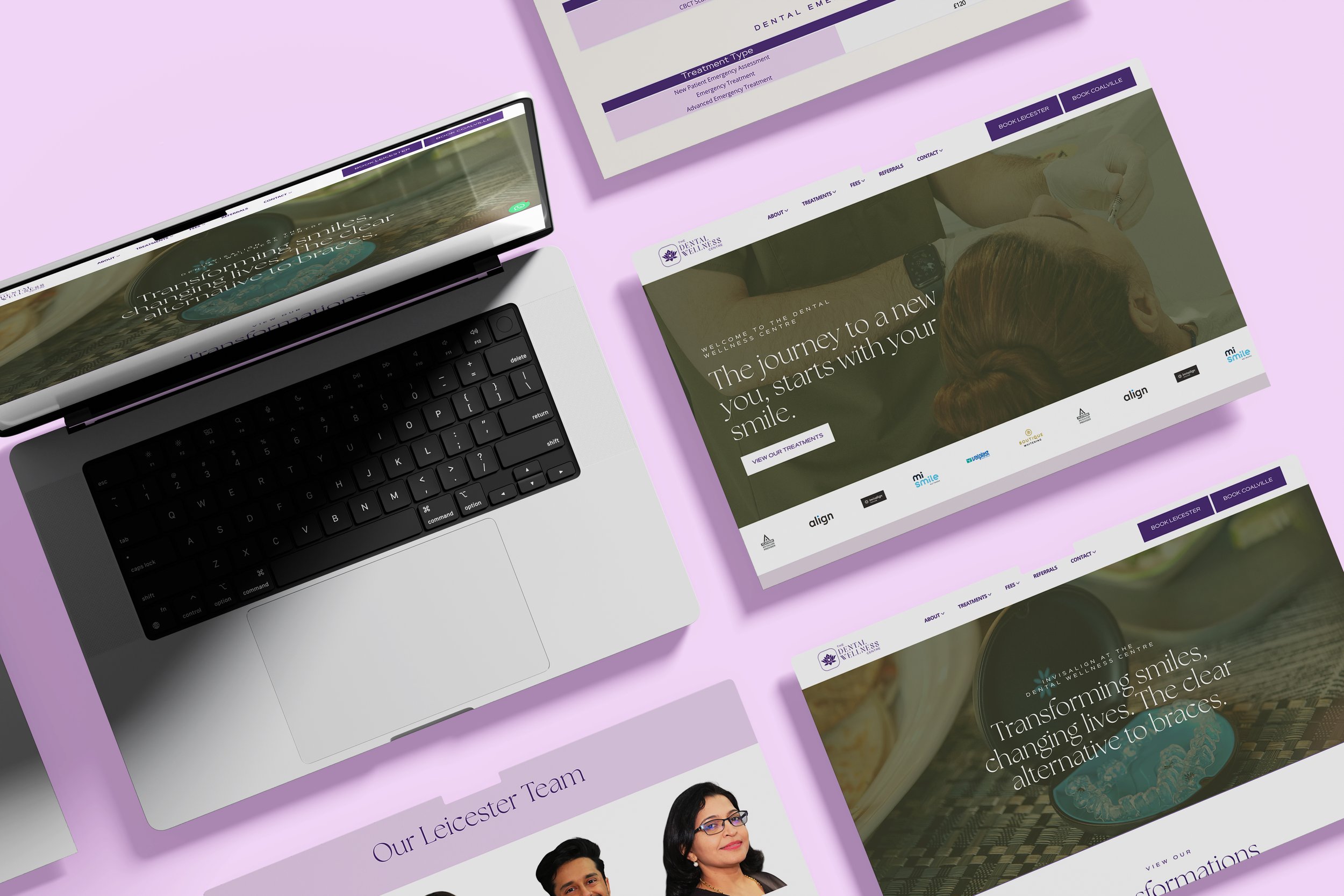 Multiple computer screens displaying a dental wellness center website with images of dental procedures and smiling patients, on a light purple background.