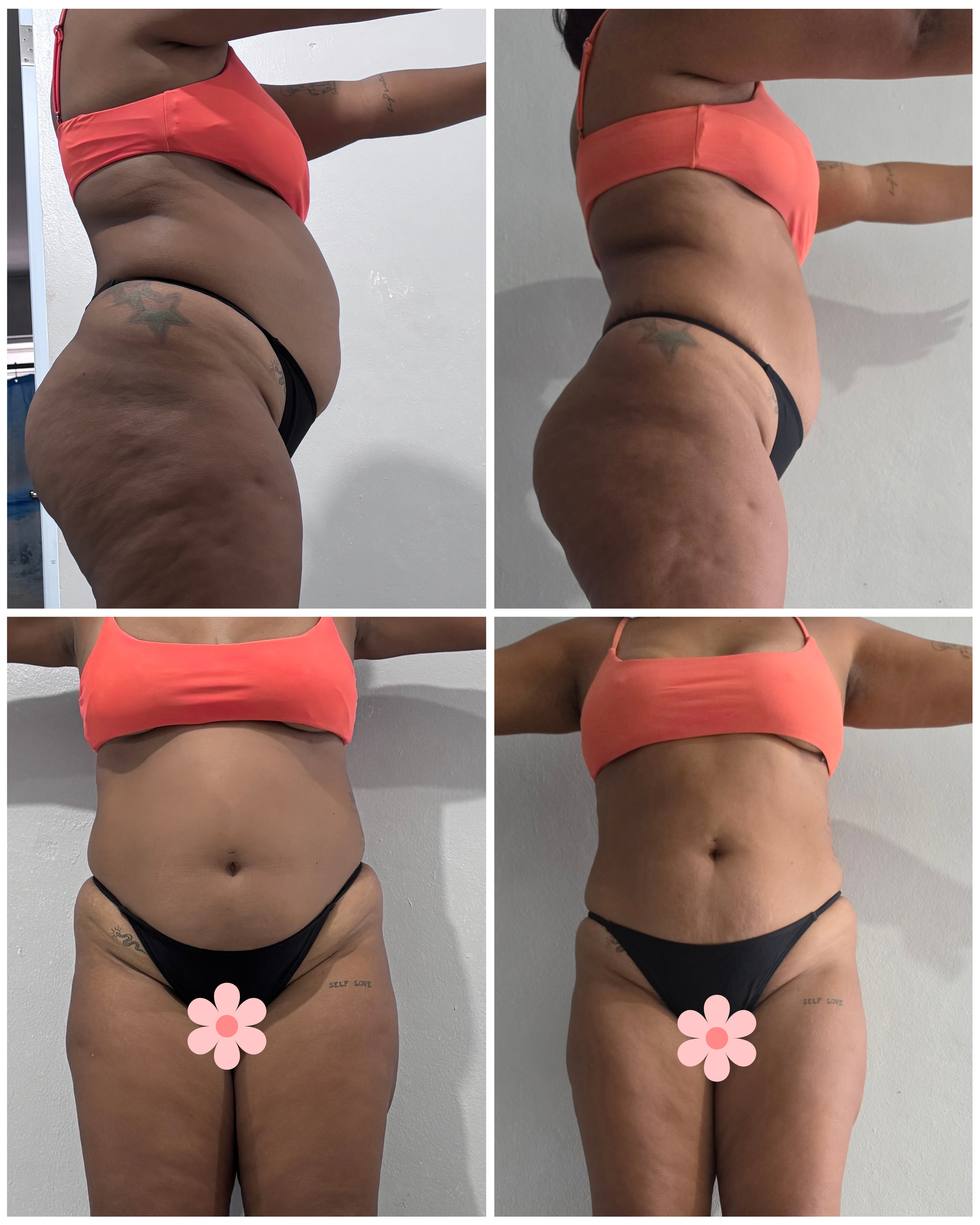 Comparación de fotos mostrando una transformación en la figura de la mujer, con cambios en la forma del abdomen y la cintura, en diferentes prendas y fondos.
