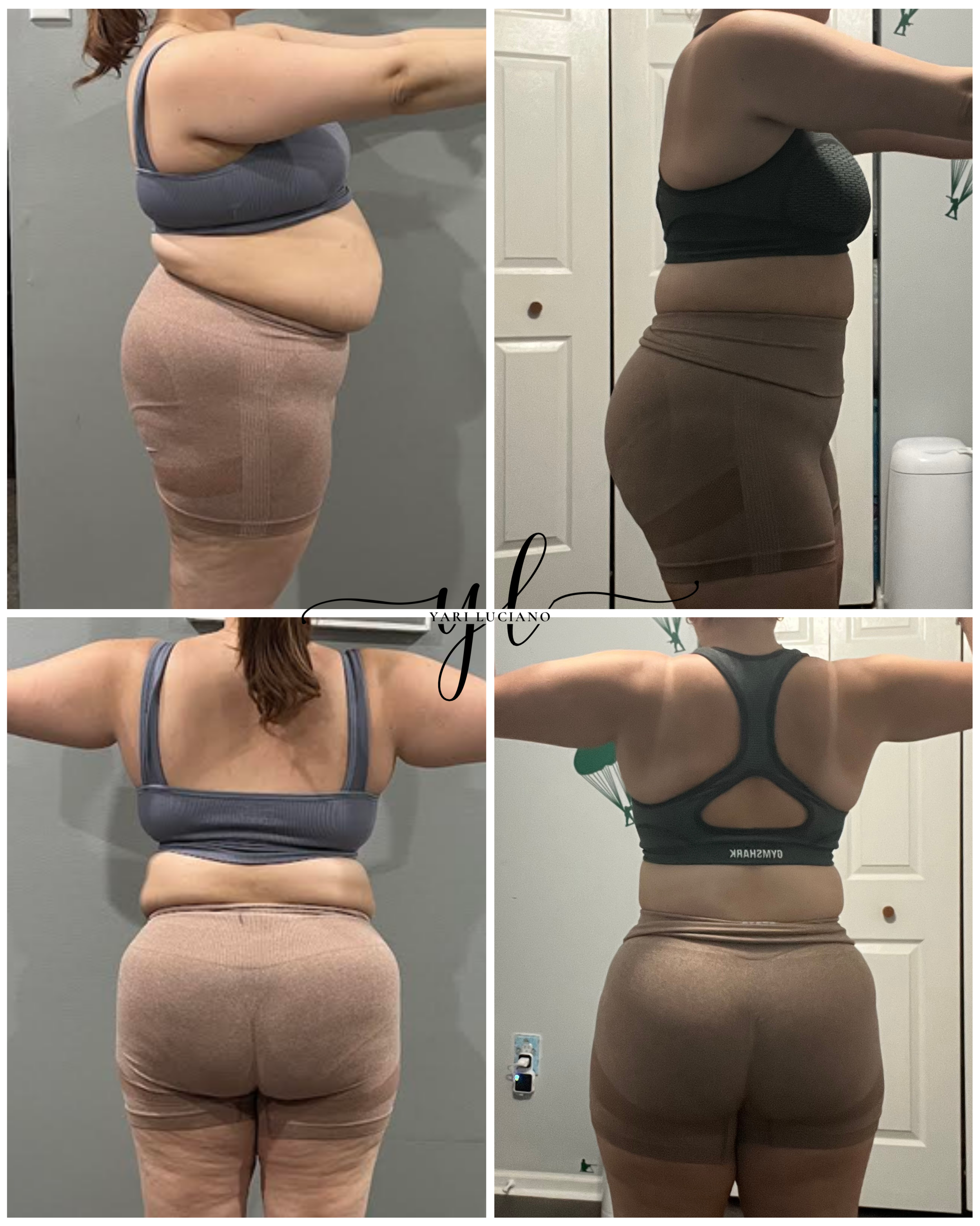 Comparación de fotos de una mujer frente y de perfil, mostrando pérdida de peso en abdomen y espalda, usando ropa deportiva en diferentes espacios.