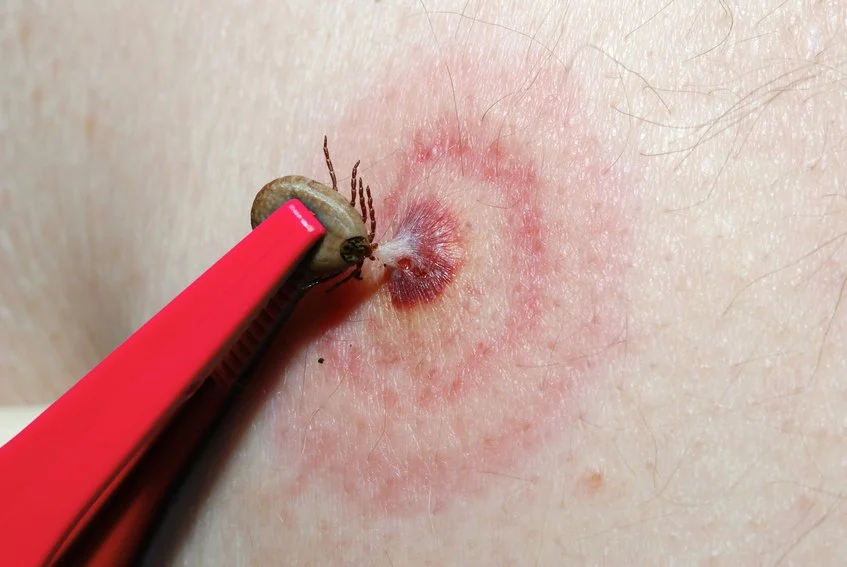 Borreliose &amp; Artemisia annua
