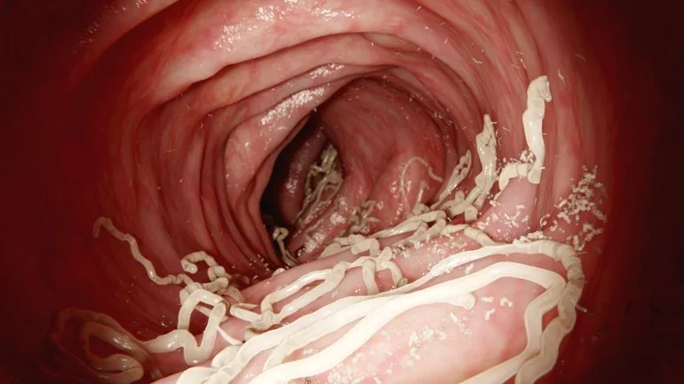 Artemisia annua bei Parasiten