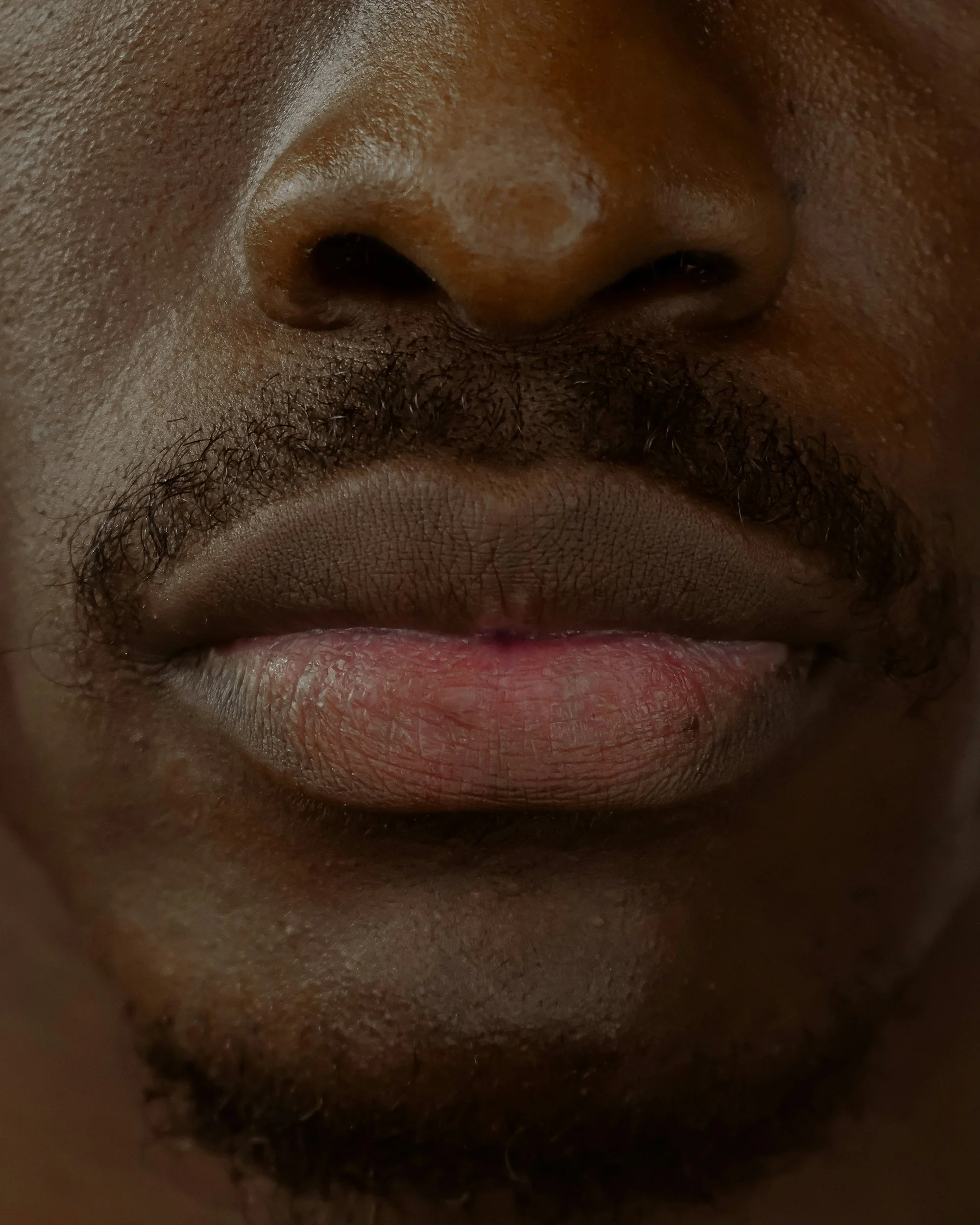 Close-up of a person's nose and upper lip, showing skin texture and facial hair.