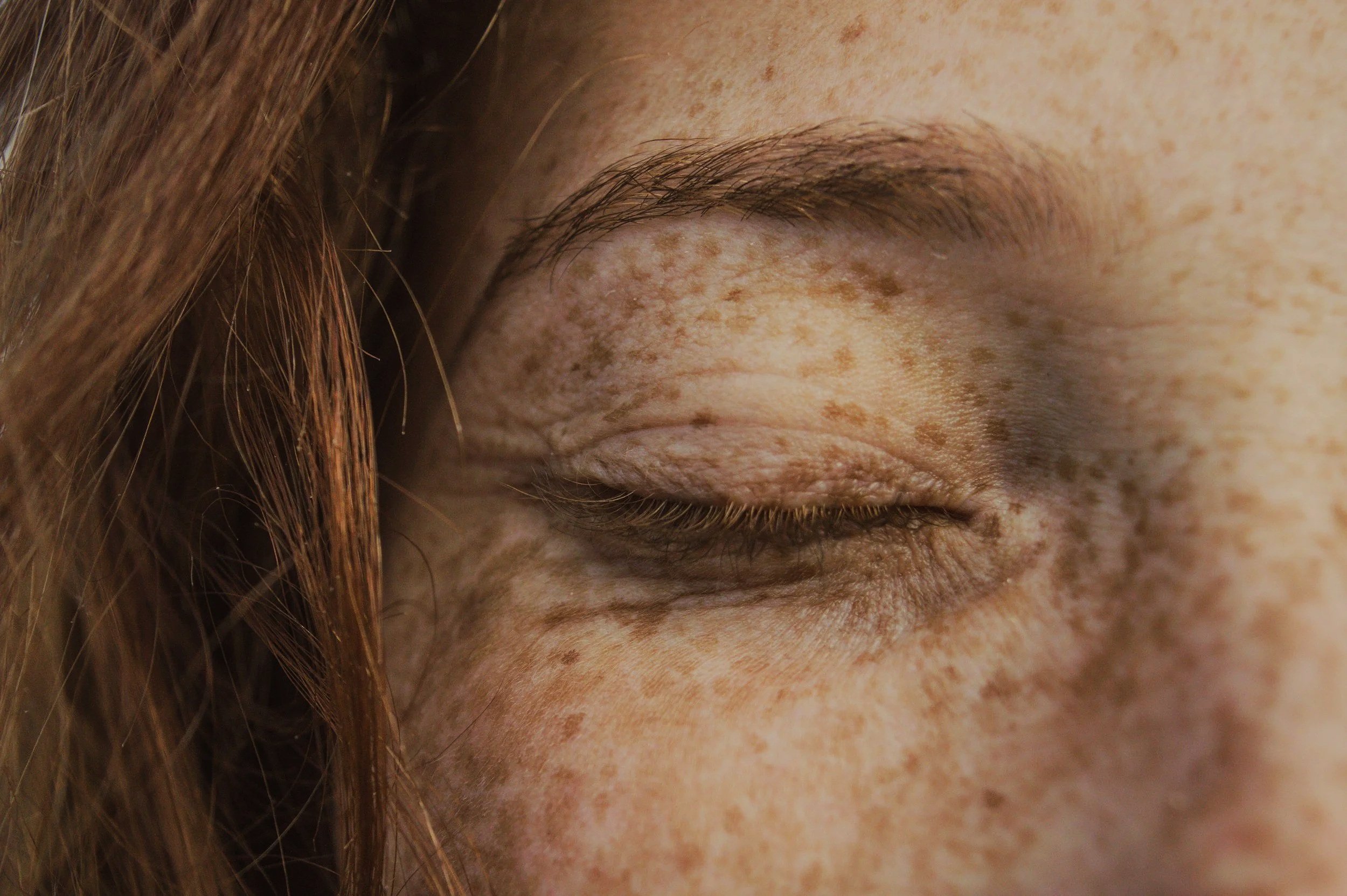 Close-up of a person's closed eye with freckles on the skin and brown hair partially visible.