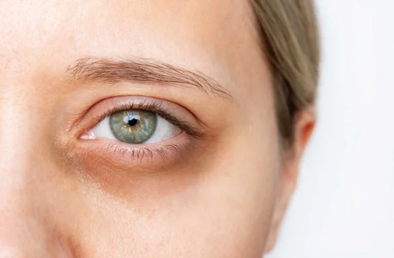 Emergency Eye Care: Common Eye Injuries &amp; Treatment