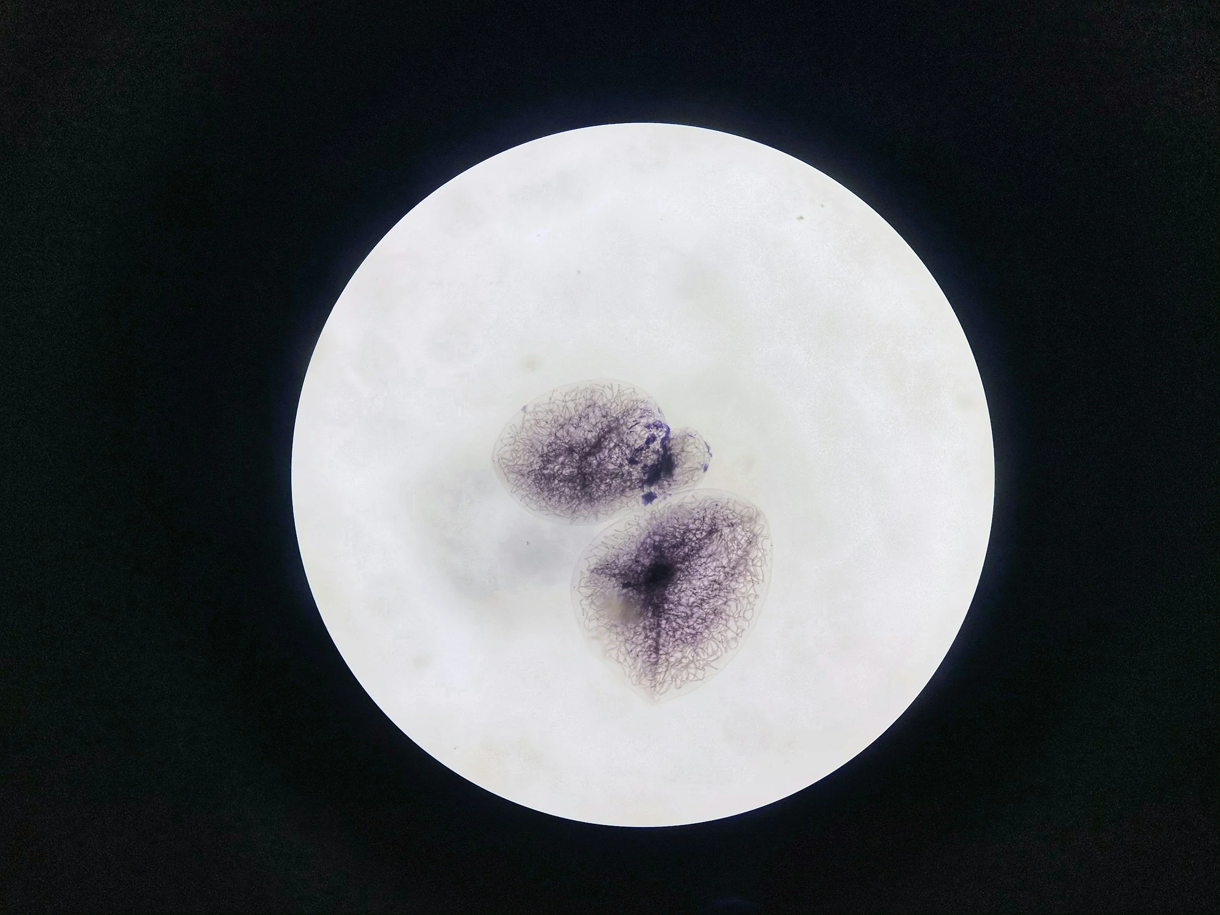 Human oocyte under microscope — fertility nutrition support