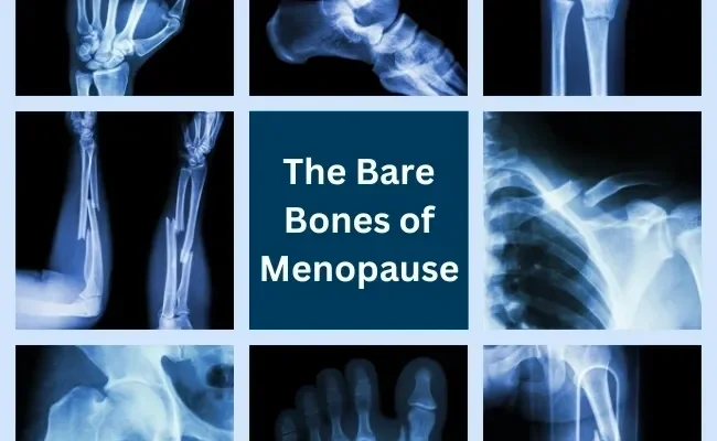 The Bare Bones of Menopause