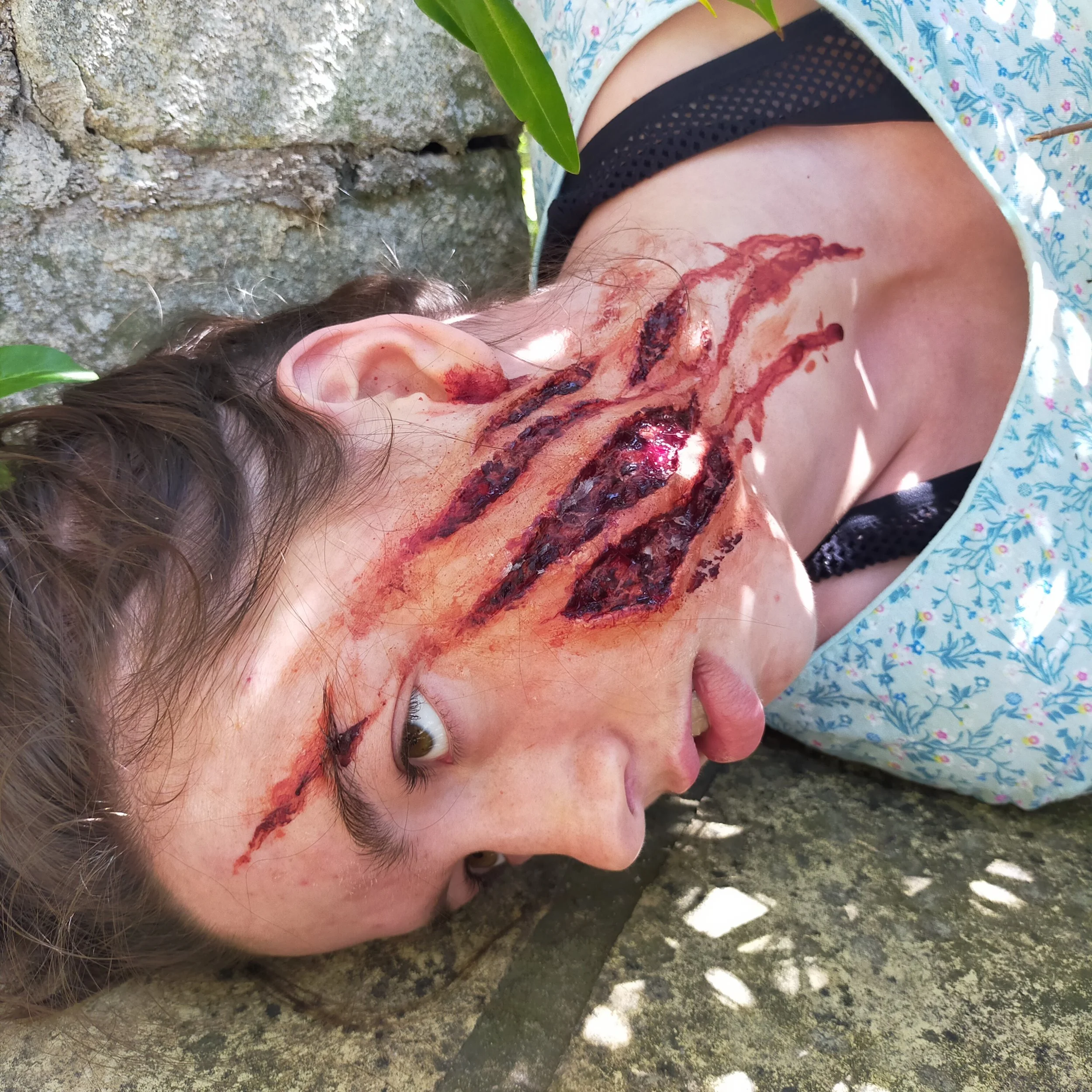 Person lying on the ground with a large, bloody, and severe facial wound.