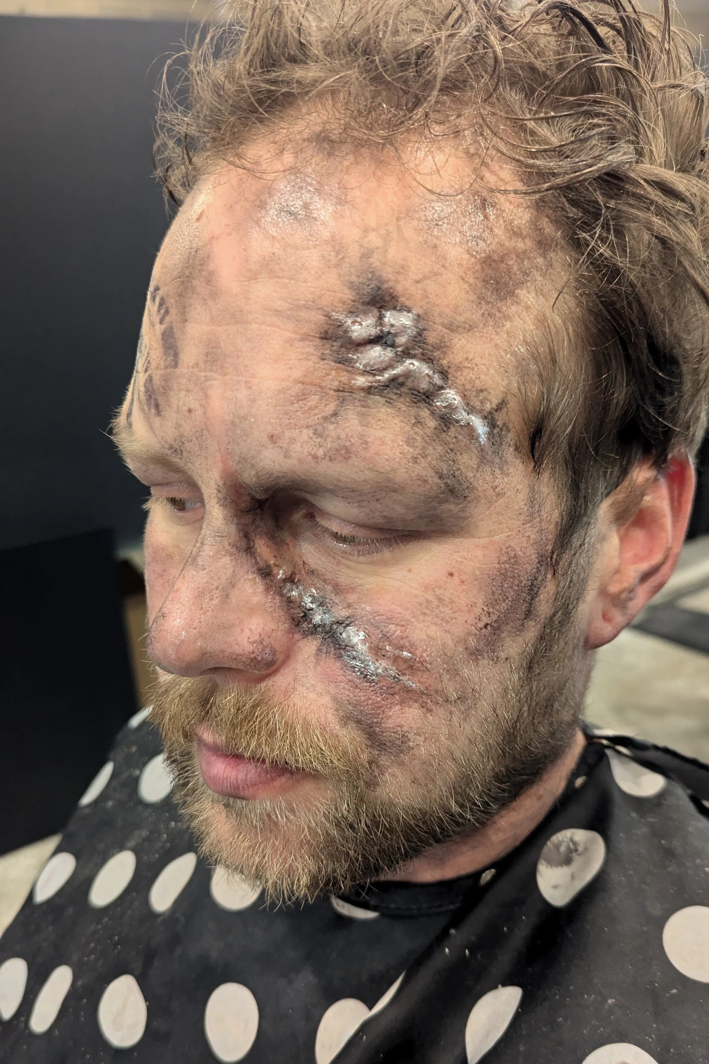 A man with scars and stitches on his face, sitting in a barber's chair wearing a polka dot cape.