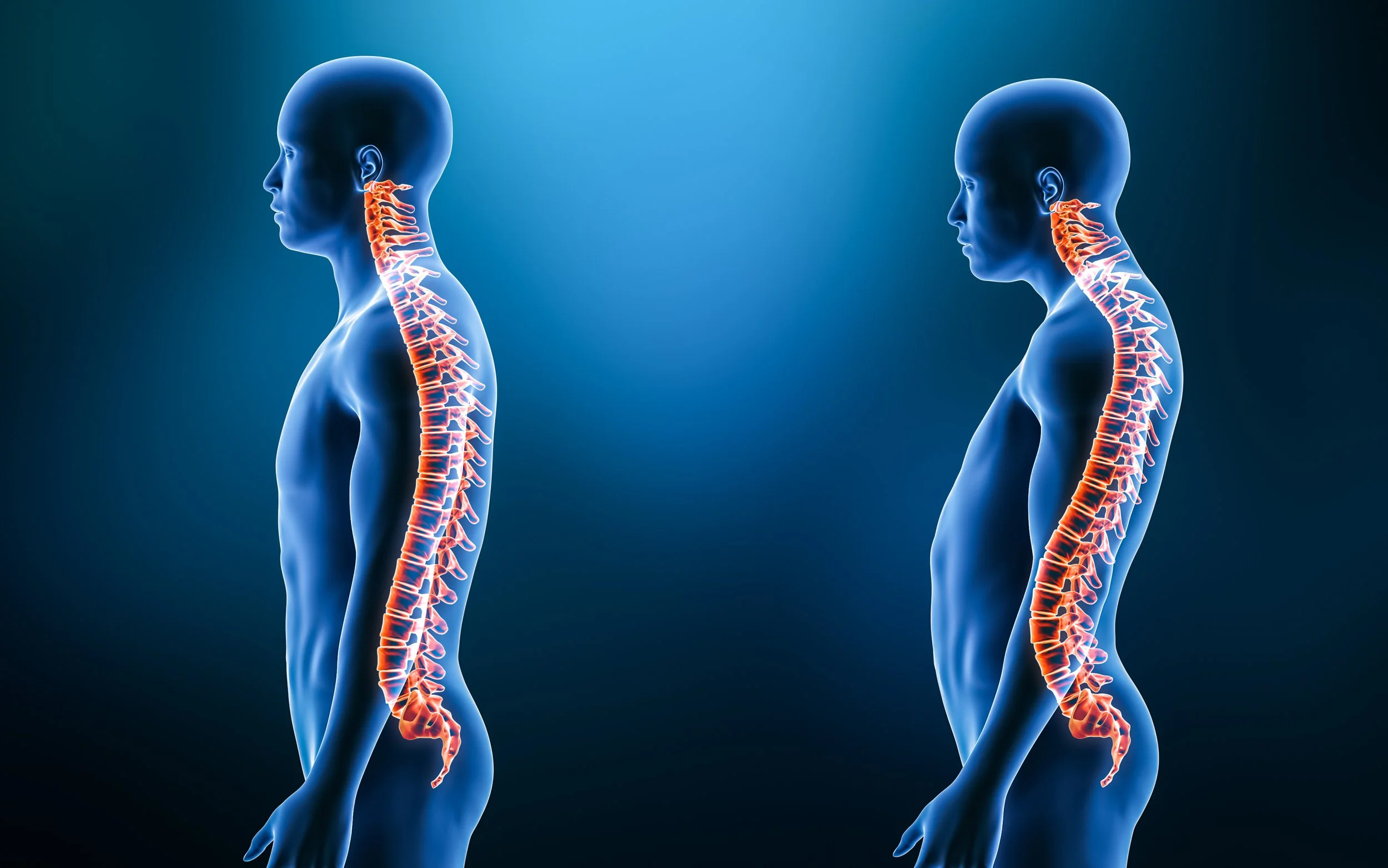Illustration of a human figure showing the spine with detailed vertebrae, viewed from the side, with a second similar figure in the background.
