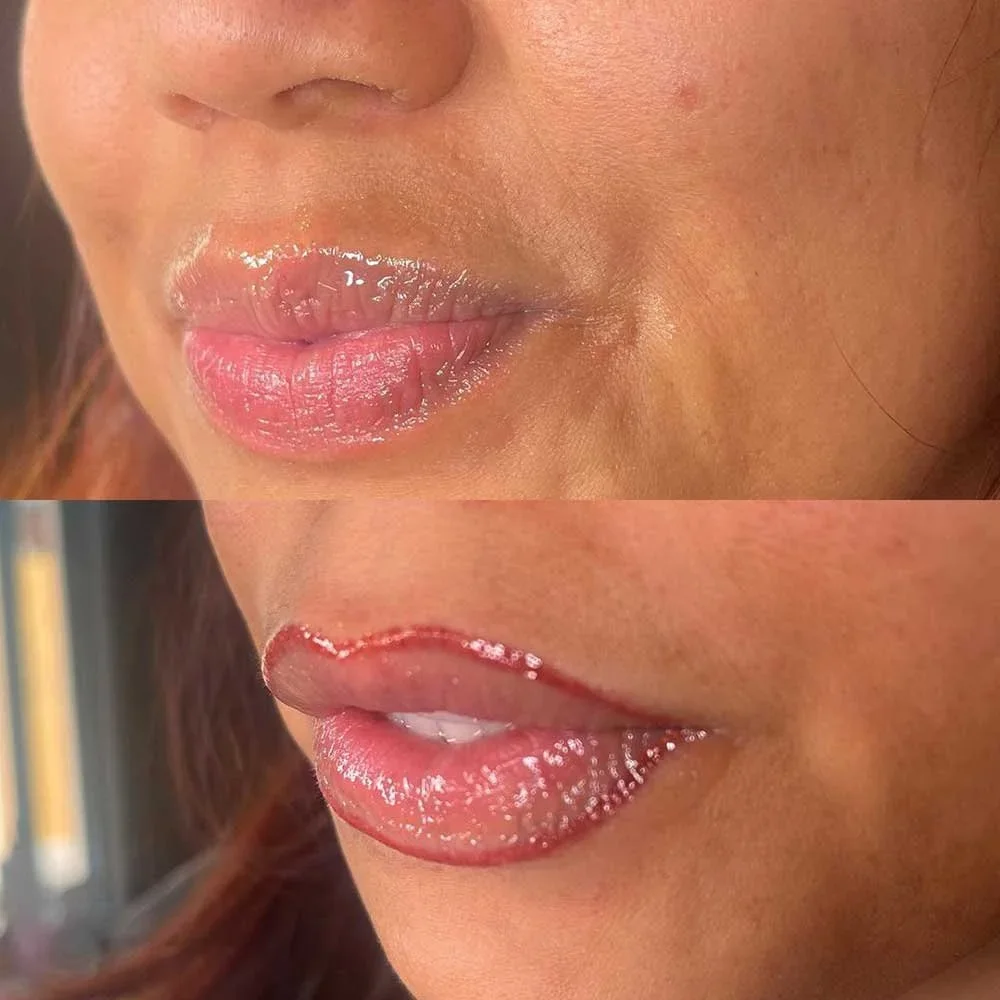 Close-up of a woman's lips before and after applying a cosmetic lip liner treatment.