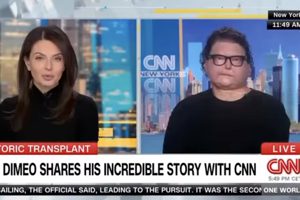 Screenshot of a CNN news interview with a woman and a man discussing a story; the woman has long dark hair and wears a black top, while the man has curly hair, glasses, and also wears black. Background shows city skyline with tall buildings; on-screen text includes CNN logo, location New York, and headlines about a medical story.