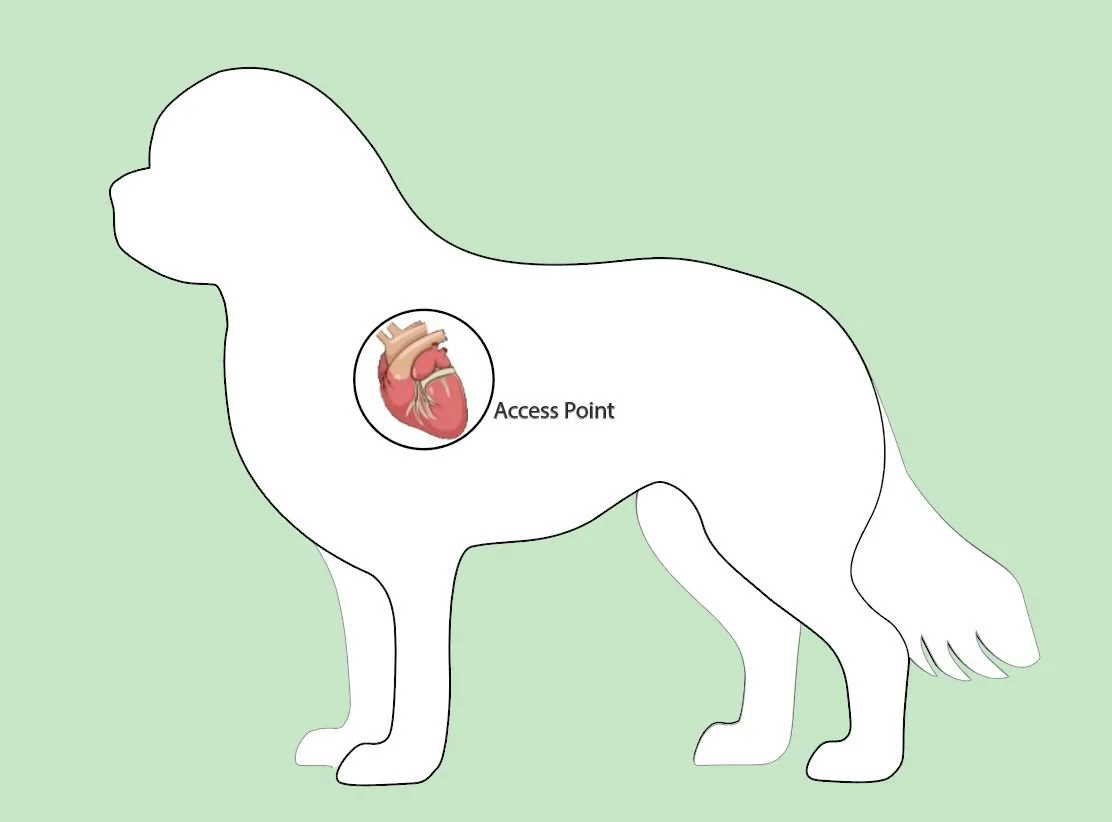Open heart surgery requires a sternotomy, sawing through the rib cage and opening the heart.