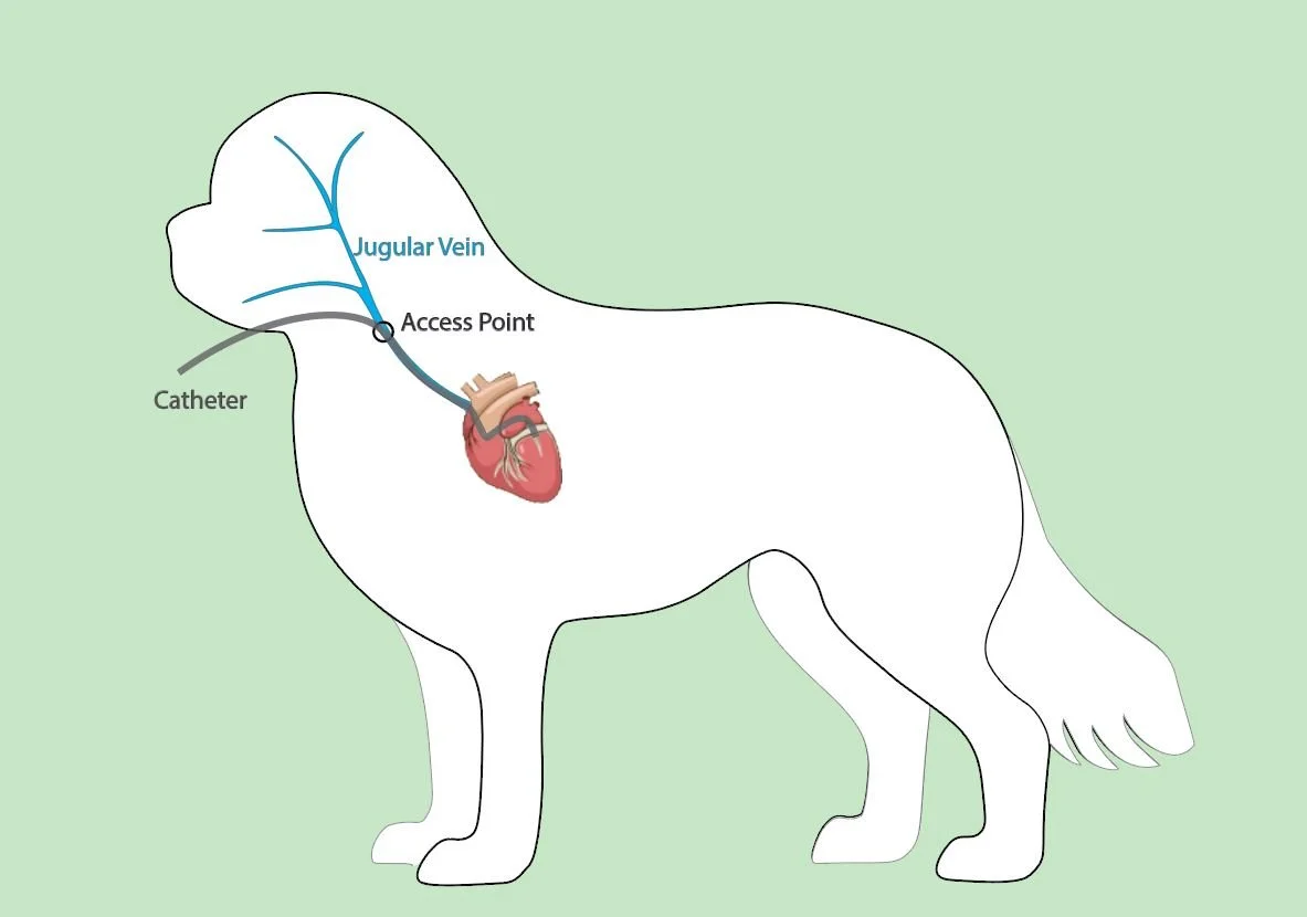 The Belka approach involved making a small incision in the jugular vein to advance a catheter into the heart. This does not require opening the chest or the heart.