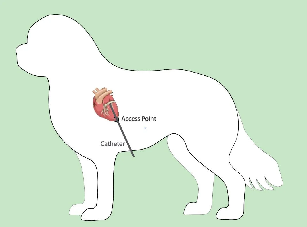 Current minimally invasive TEER procedures requires opening the chest and opening the heart.