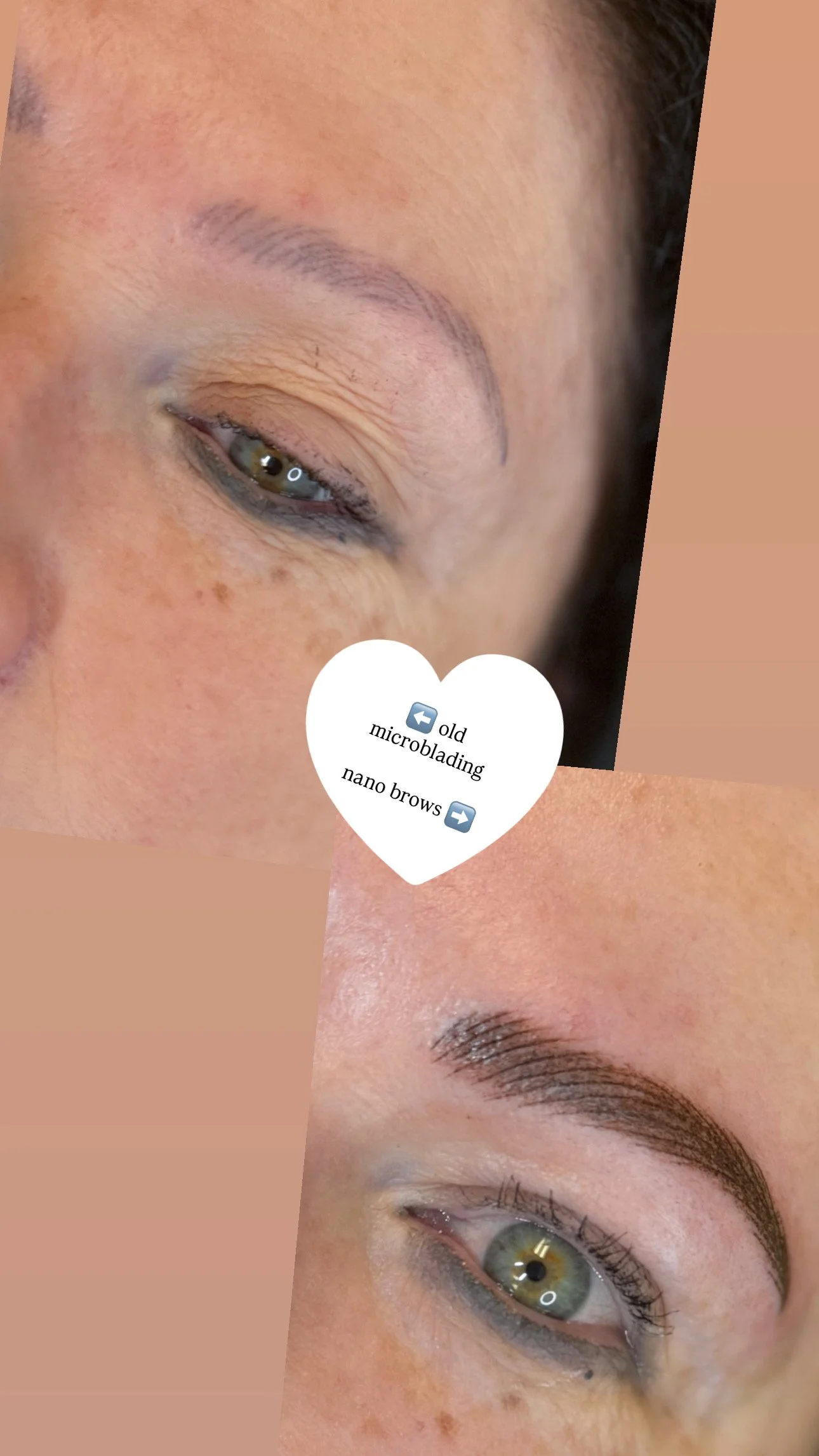 microbladingbeforeandafter.JPG