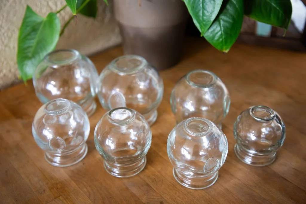 Cupping in Traditional Chinese Medicine