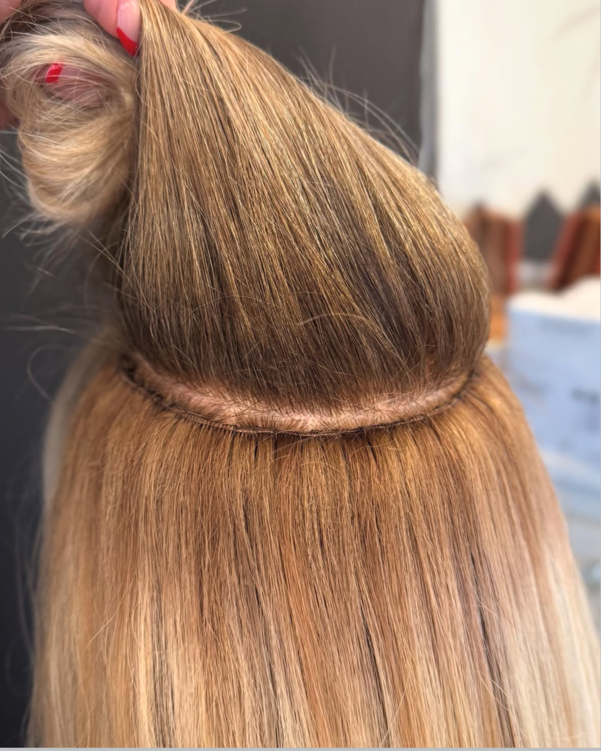 Close-up of a person's head with blond hair, showing a hair transplant or hairline procedure.