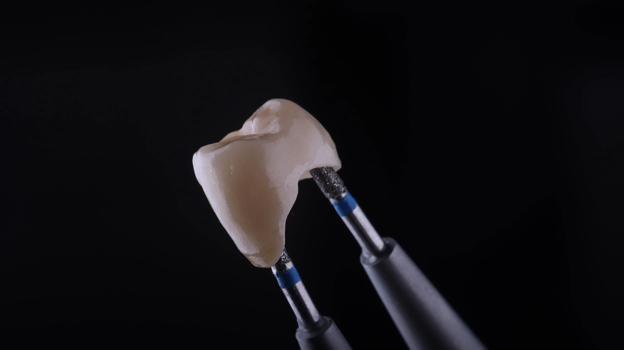Corona Zirconia monolítica