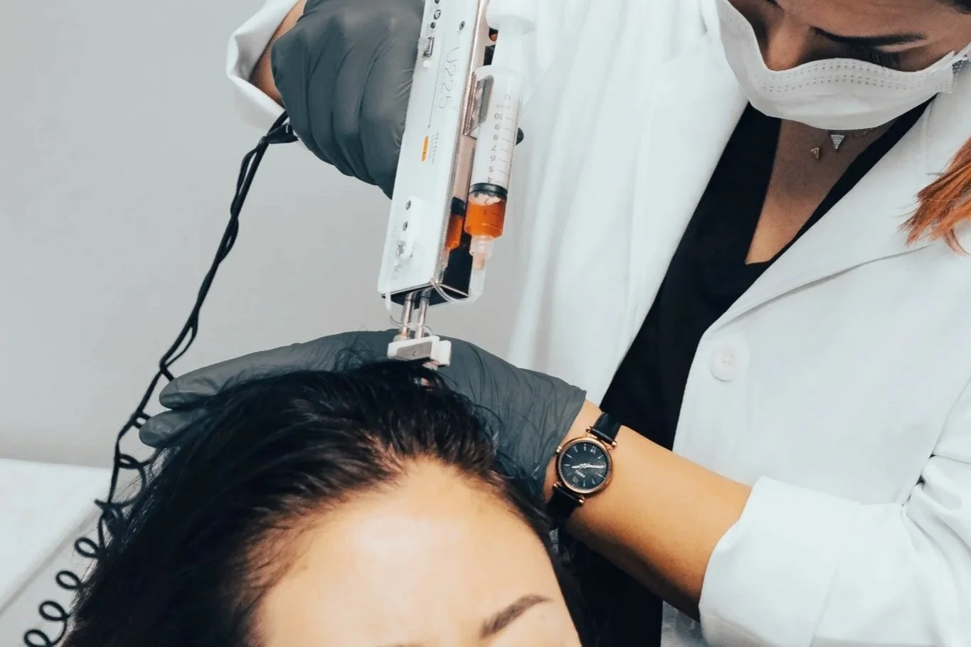 How Does PRP Hair Restoration Work? The Science Behind PRP for Hair Loss in Ottawa