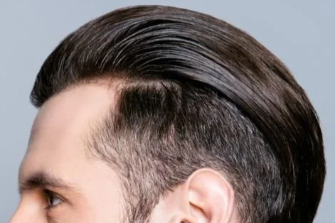 Man with styled hair representing custom hair systems and non-surgical hair replacement in Ottawa
