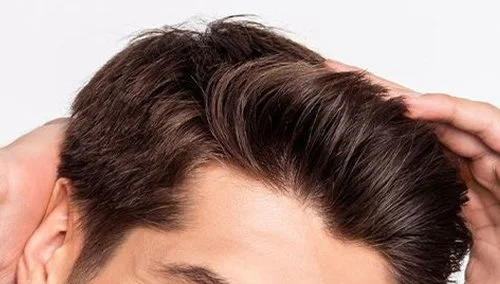 Man with styled hair representing hair transplant and surgical hair restoration services in Ottawa