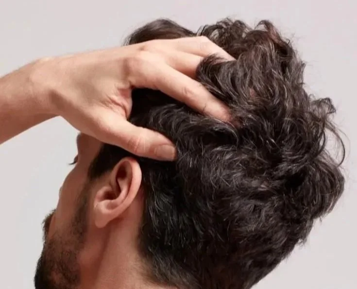 Hair Transplant in Ottawa: What to Expect From Start to Finish