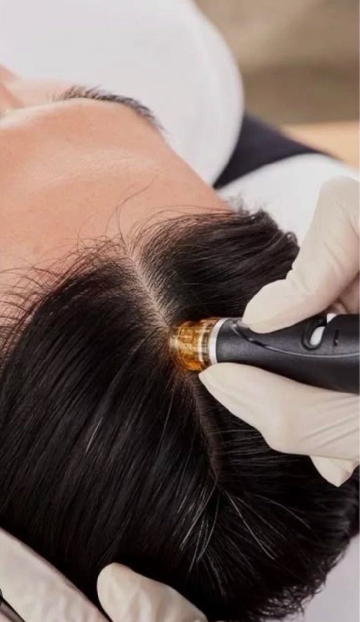 Scalp analysis examination using magnification device at Ottawa hair restoration clinic