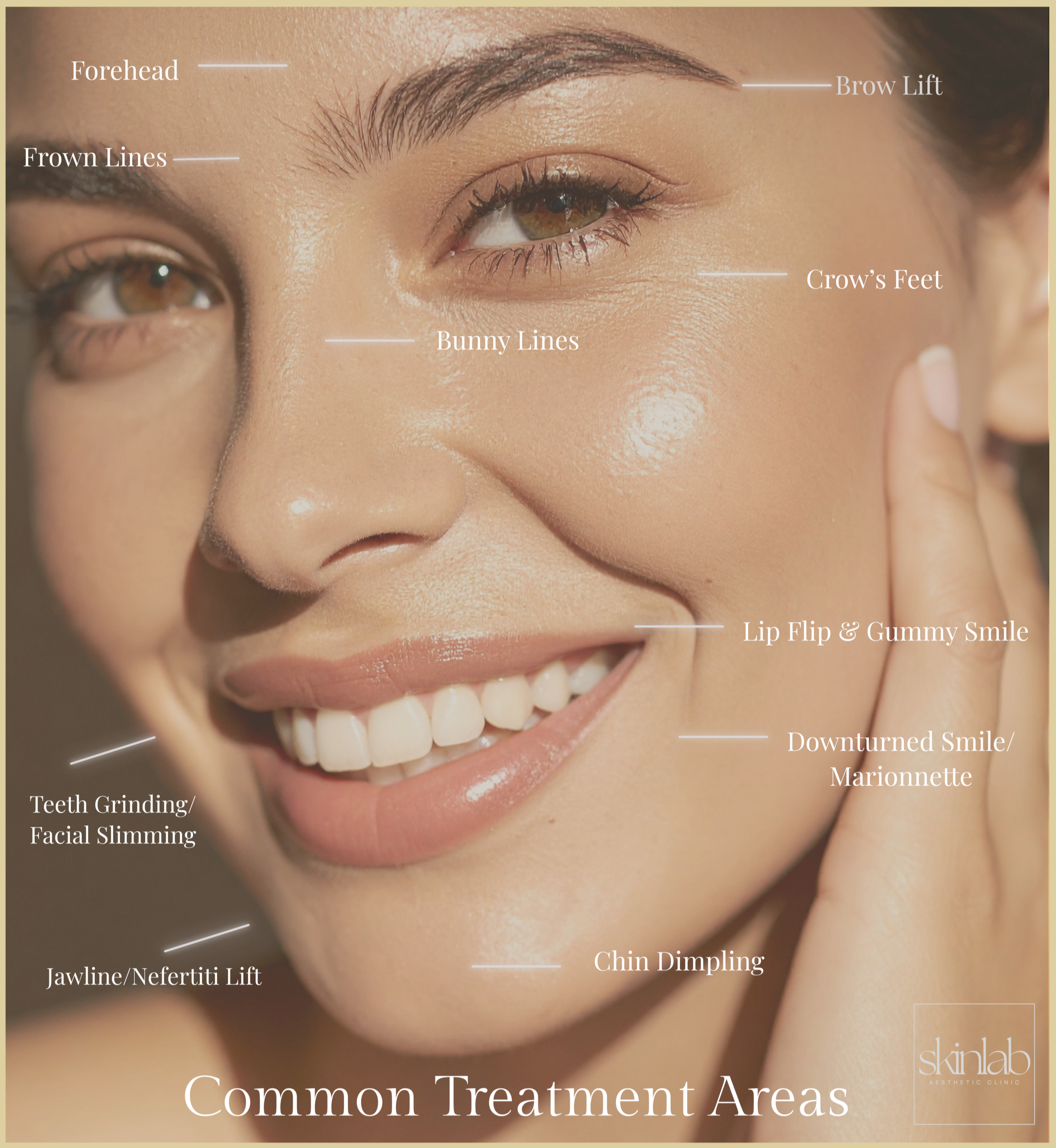 Botox and injectable treatment areas at SkinLab Aesthetic Clinic in Tallahassee, FL.