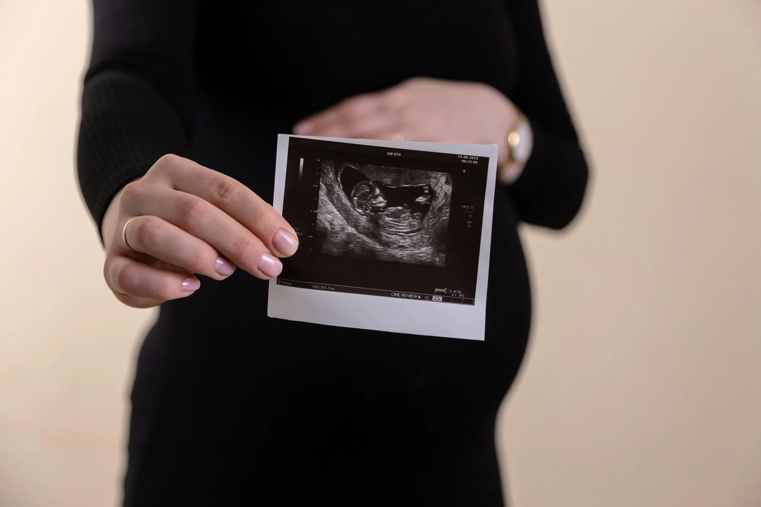 The Implantation Timeline A Day-by-Day Journey