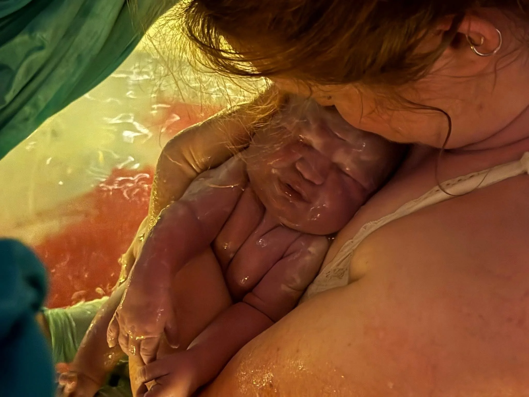 Post Partum Care Package