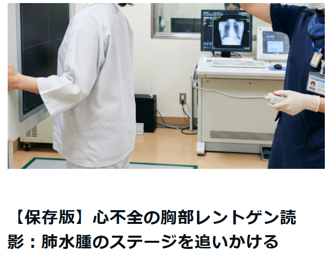 心不全の胸部レントゲン読影：肺水腫のステージを追いかける