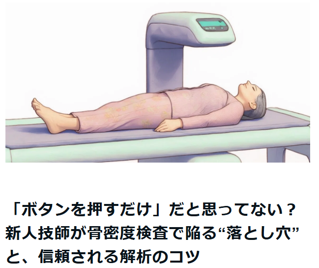 「ボタンを押すだけ」だと思ってない？新人技師が骨密度検査で陥る“落とし穴”と、信頼される解析のコツ