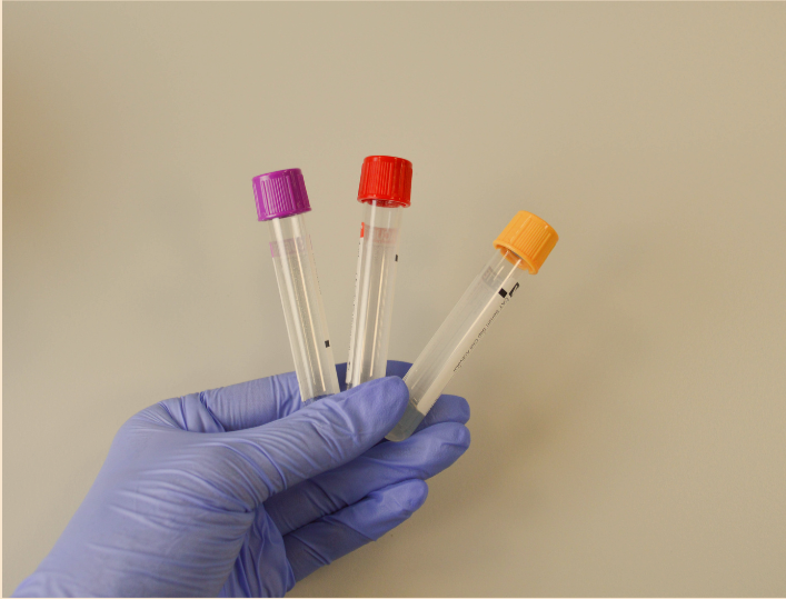 A gloved hand holding three test tubes with colored caps (purple, red, orange) against a plain background.