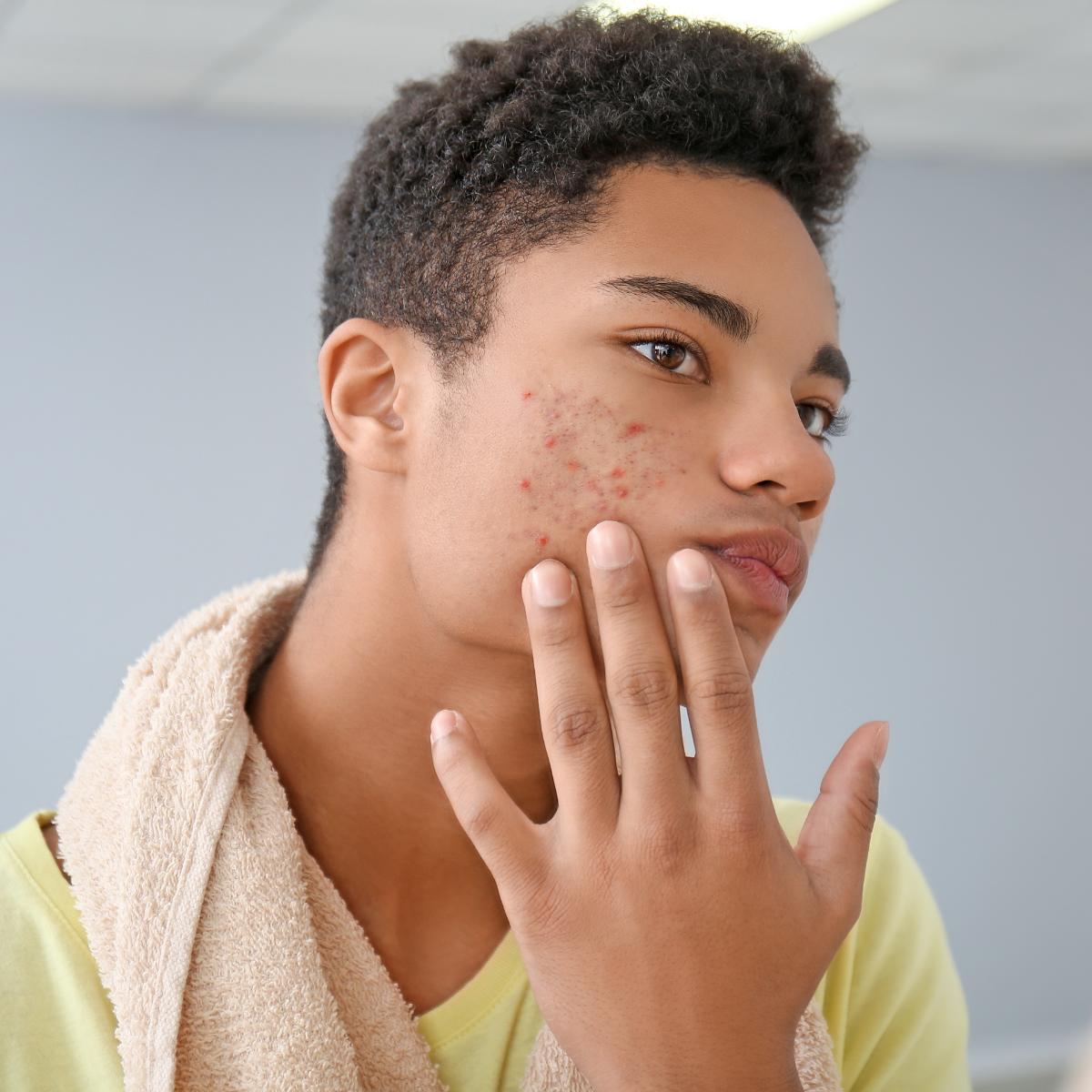 Limpieza Facial Profunda para Adolescentes