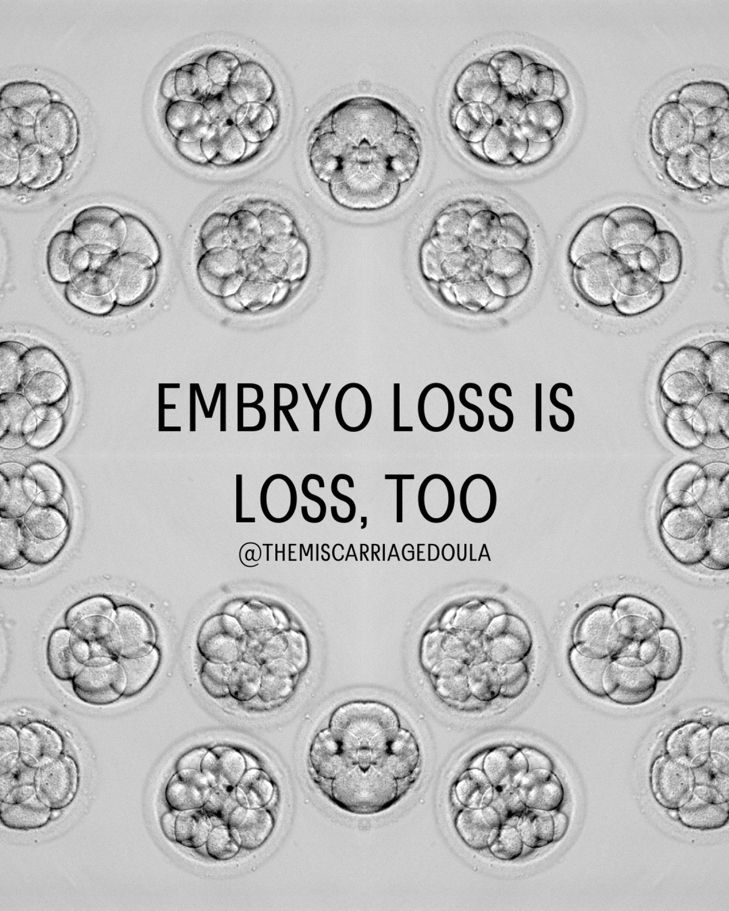 There are a lot of ways that people might feel embryo loss. Through the IVF process, failed transfers, or what's referred to as a "chemical" pregnancy. No matter how loss happens, there is grief that lives along after the loss itself.

A lo