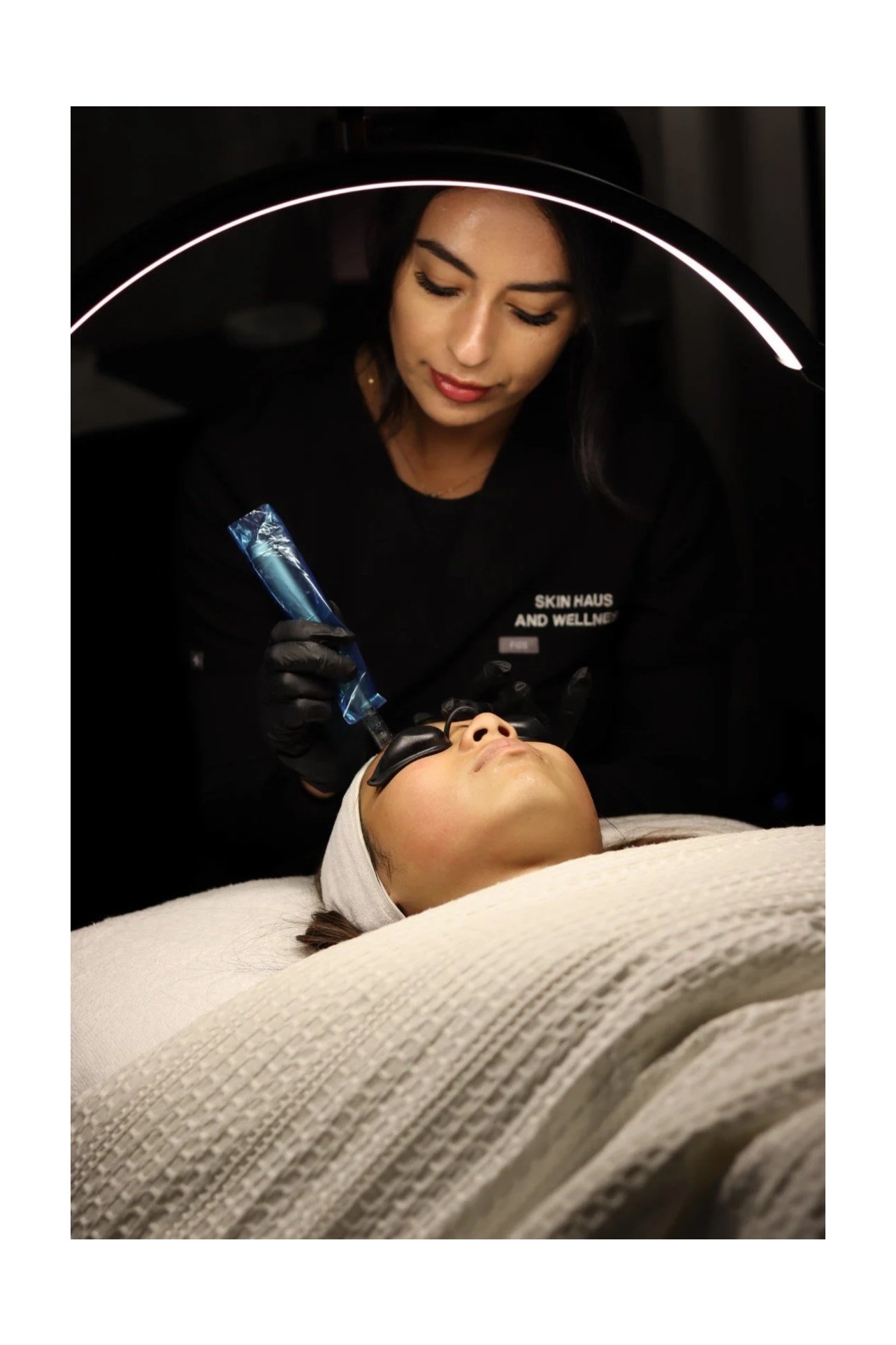 Microneedling (face and neck) series of 3