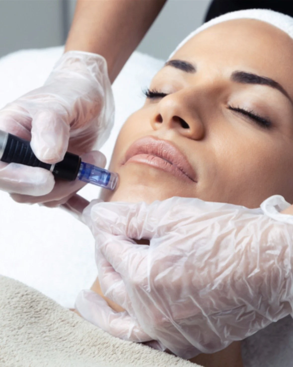 Microneedling - Visage et Corps