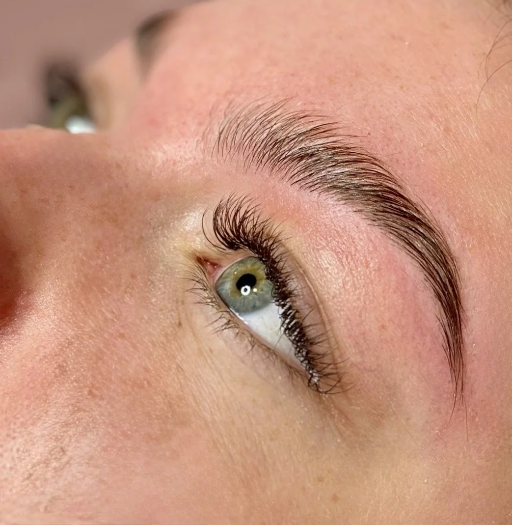 Rehaussement des sourcils (Browlift)