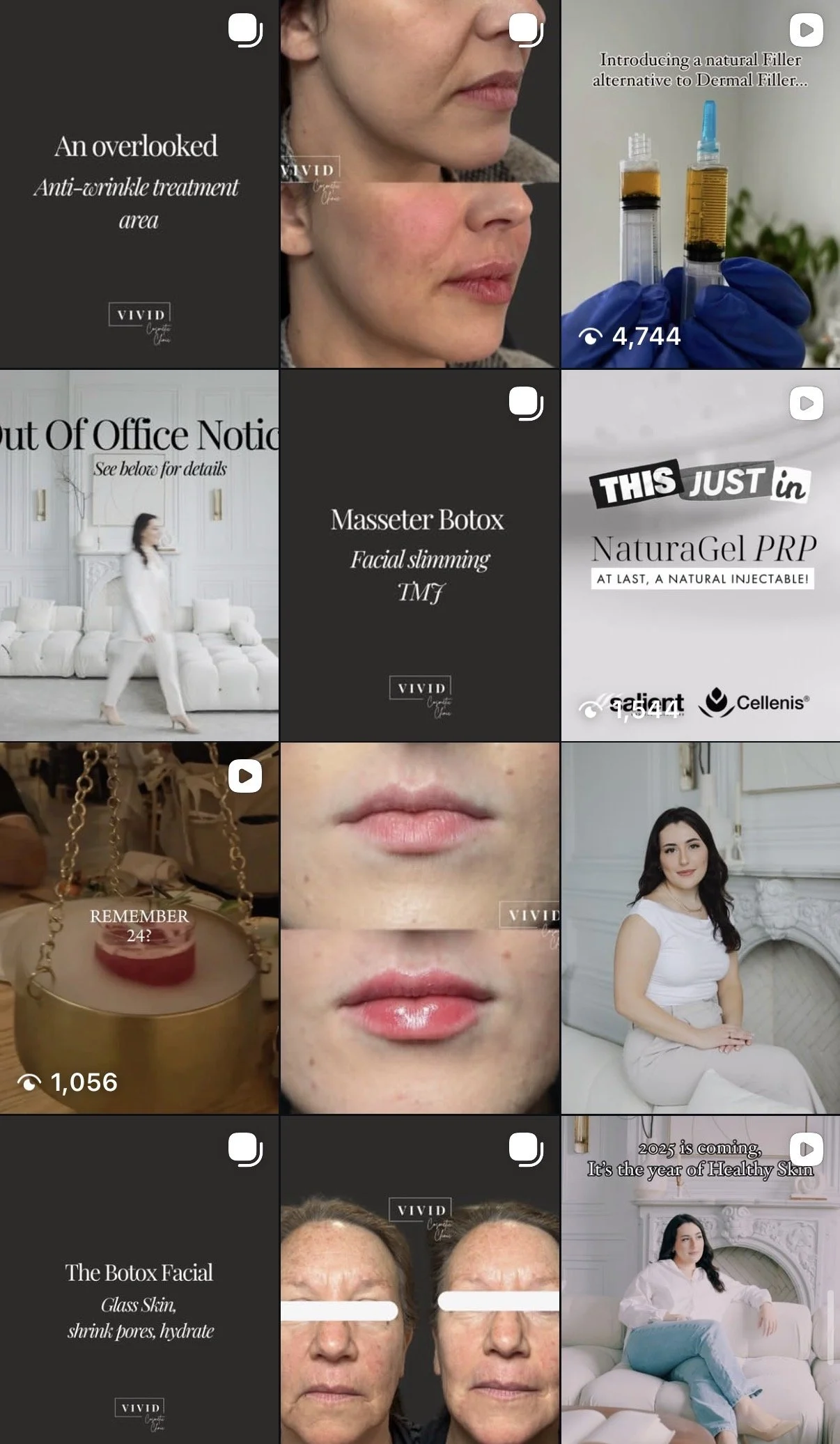 A collage of skincare treatments, cosmetic procedures, and promotional content showcasing anti-aging and facial slimming products, including botox and natural injectables, with before-and-after images and models demonstrating results.