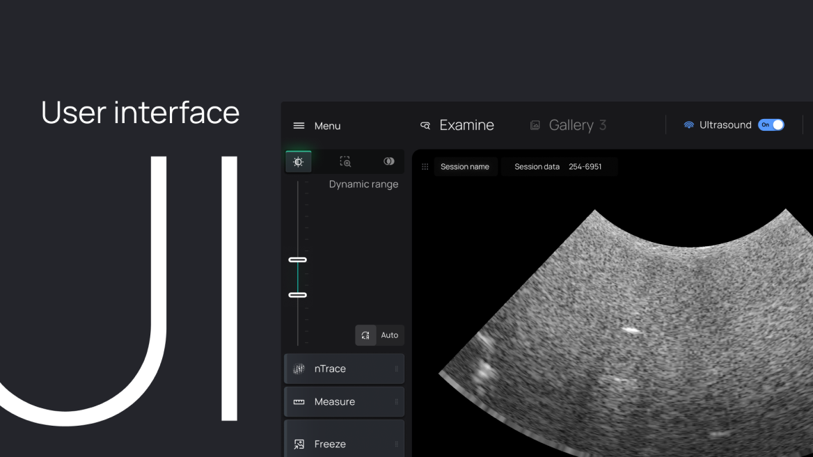 NanoEcho interface from Less's published case
