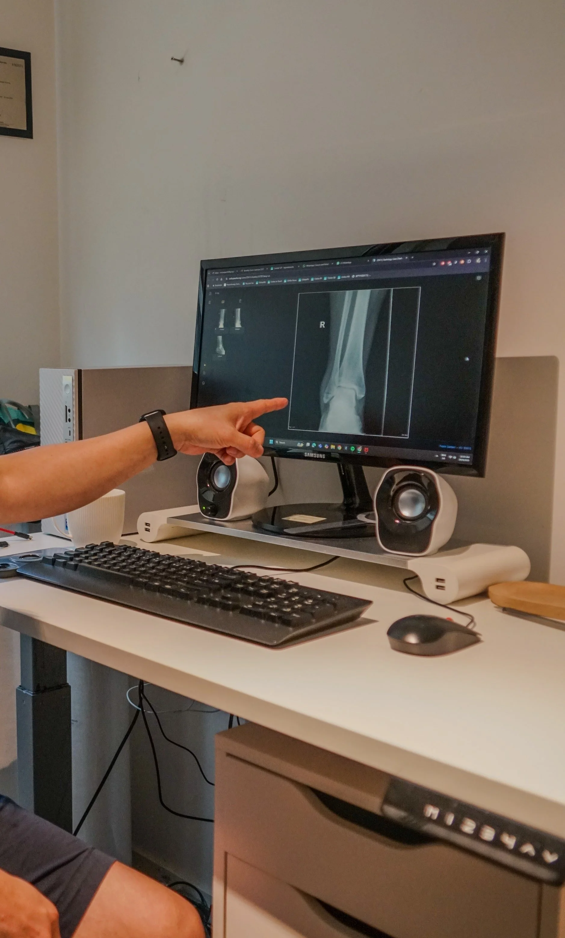 A person pointing to an X-ray of an ankle on a computer monitor in a medical office setting.